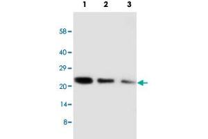Western blot analysis of CDC42 recombinant protein with CDC42 polyclonal antibody .