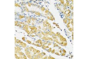 Immunohistochemistry (Paraffin-embedded Sections) (IHC (p)) image for anti-Heat Shock 70kDa Protein 9 (Mortalin) (HSPA9) (AA 380-679) antibody (ABIN3021000)