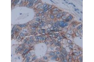 Immunohistochemistry (IHC) image for anti-Tumor Necrosis Factor (Ligand) Superfamily, Member 12 (TNFSF12) (AA 148-247) antibody (ABIN1860803)