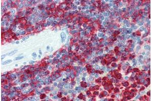 Spleen, Human: Formalin-Fixed, Paraffin-Embedded (FFPE) (Integrin beta 2 Antikörper  (AA 534-546))
