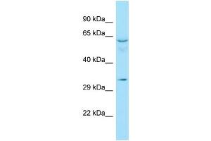 WB Suggested Anti-RAD51D Antibody Titration: 1.