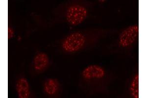 Immunofluorescence staining of methanol-fixed HeLa cells using Phospho-MAPKAPK2-T334 antibody (ABIN2988148). (MAPKAP Kinase 2 Antikörper  (pThr334))