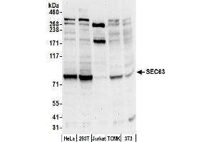 anti-SEC63 Homolog (SEC63) (AA 700-750) antibody