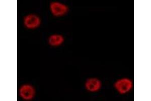 ABIN6275741 staining Hela by IF/ICC. (TEAD3 Antikörper  (Internal Region))