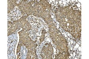 IHC analysis of PDIA5 using anti-PDIA5 antibody (ABIN7601801). (PDIA5 Antikörper  (AA 46-481))