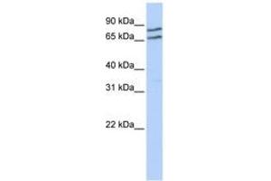 Image no. 1 for anti-Transcription Factor E3 (TFE3) (AA 324-373) antibody (ABIN6742380) (TFE3 Antikörper  (AA 324-373))
