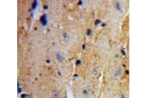 IHC-P analysis of Heart tissue, with DAB staining. (UCHL3 Antikörper  (C-Term))