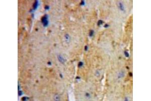 IHC-P analysis of Heart tissue, with DAB staining.