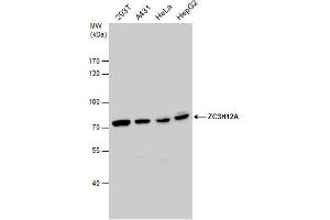 WB Image ZC3H12A antibody detects ZC3H12A protein by western blot analysis. (ZC3H12A Antikörper)