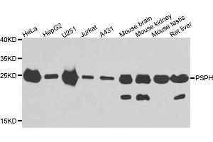 Western blot analysis of extracts of various cell lines, using PSPH antibody.