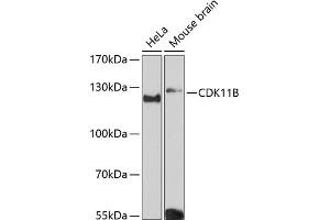 Western blot analysis of extracts of various cell lines, using CDK11B Antibody (ABIN6130092, ABIN6138305, ABIN6138306 and ABIN6216598) at 1:3000 dilution. (CDK11 Antikörper  (AA 1-130))