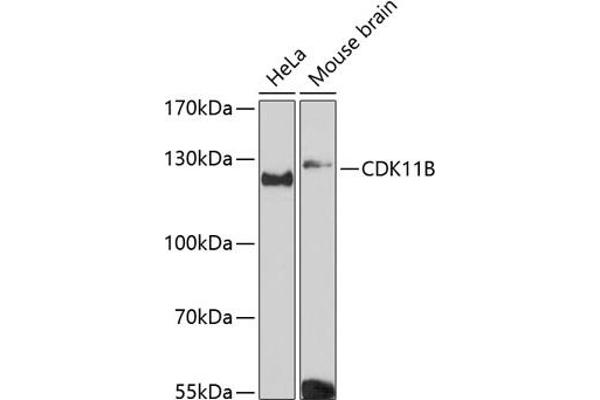 CDK11 Antikörper  (AA 1-130)