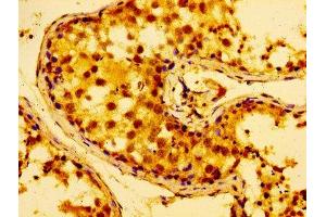 IHC image of ABIN7142604 diluted at 1:100 and staining in paraffin-embedded human testis tissue performed on a Leica BondTM system.