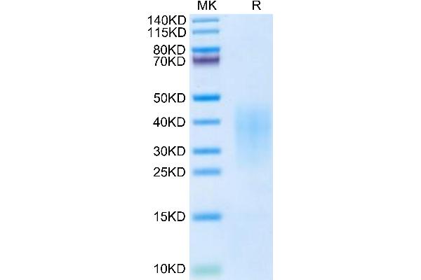 IL-13 Protein (AA 19-132) (His tag)