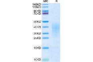 Cynomolgus IL-13 on Tris-Bis PAGE under reduced condition. (IL-13 Protein (AA 19-132) (His tag))