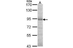 WB Image Sample (30 ug of whole cell lysate) A: A549 7. (DPP8 Antikörper)