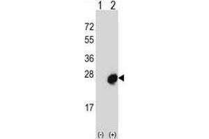 Western blot analysis of Mid1-interacting protein 1 (arrow) using rabbit polyclonal MID1IP1 Antibody  (N-term). (m1ip1 Antikörper  (N-Term))