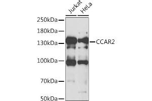 Western blot analysis of extracts of various cell lines, using CC antibody (ABIN6133528, ABIN6138034, ABIN6138035 and ABIN6222941) at 1:1000 dilution. (CCAR2 Antikörper  (AA 654-923))