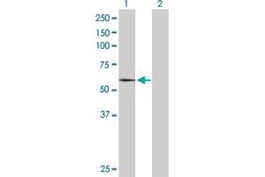 Western Blotting (WB) image for anti-TAF6 RNA Polymerase II, TATA Box Binding Protein (TBP)-Associated Factor, 80kDa (TAF6) (AA 1-677) antibody (ABIN520668)