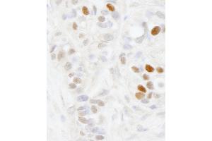 Immunohistochemistry (IHC) image for anti-Melanoma Antigen Family D, 2 (MAGED2) (AA 50-100) antibody (ABIN7448635) (MAGED2 Antikörper  (AA 50-100))