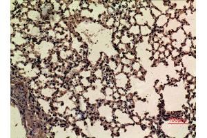 Immunohistochemistry (IHC) image for anti-Nuclear Factor (erythroid-Derived 2)-Like 2 (NFE2L2) (acLys599) antibody (ABIN3188008)