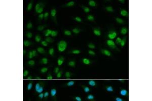 Immunofluorescence analysis of HeLa cells using MCM7 Polyclonal Antibody (MCM7 Antikörper)