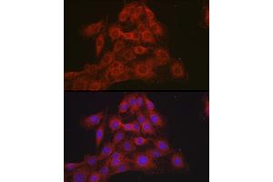 Immunofluorescence (IF) image for anti-Nuclear Receptor Subfamily 3, Group C, Member 2 (NR3C2) (C-Term) antibody (ABIN1681109)