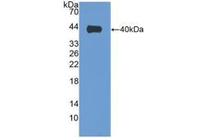 Western blot analysis of recombinant Human VIL1. (Villin 1 Antikörper  (AA 1-320))