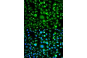 Immunofluorescence analysis of MCF7 cell using TEK antibody. (TEK Antikörper)