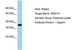 Image no. 1 for anti-Olfactory Receptor, Family 51, Subfamily V, Member 1 (OR51V1) (AA 206-255) antibody (ABIN6749901) (OR51V1 Antikörper  (AA 206-255))