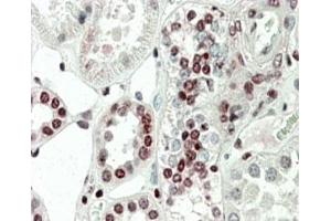 IHC staining of FFPE human kidney with PRAK antibody at 5ug/ml. (MAPKAP Kinase 5 Antikörper)