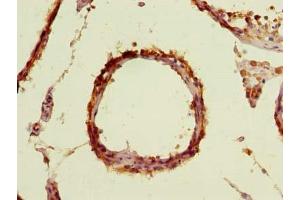 Immunohistochemistry of paraffin-embedded human testis tissue using ABIN7171606 at dilution of 1:100 (TBC1D19 Antikörper  (AA 1-300))