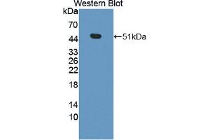 Western blot analysis of the recombinant protein. (CPA3 Antikörper  (AA 16-417))