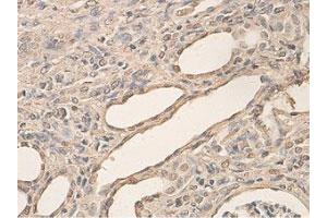 Immunohistochemical staining of formalin-fixed paraffin-embedded rat kidney tissue showing cytoplasmic and nuclear staining with AHR polyclonal antibody  at 1 : 200 dilution. (Aryl Hydrocarbon Receptor Antikörper  (N-Term))
