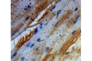 Used in DAB staining on fromalin fixed paraffin-embedded Heart tissue (BDNF Antikörper  (AA 129-247))