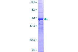 WDR5B Protein (AA 1-330) (GST tag)