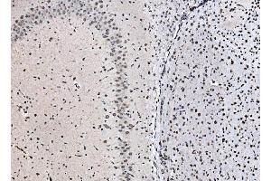 IHC analysis of DBC-1/CCAR2 using anti-DBC-1/CCAR2 antibody (ABIN7602235).