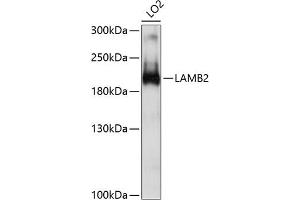 Western blot analysis of extracts of LO2 cells, using L antibody (ABIN6132095, ABIN6143070, ABIN6143071 and ABIN6214860) at 1:1000 dilution. (LAMB2 Antikörper  (AA 1579-1798))