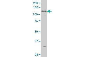 Image no. 3 for anti-ABL2 (ABL2) (AA 743-842) antibody (ABIN465946) (ABL2 Antikörper  (AA 743-842))