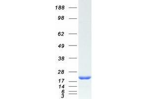 Western Blotting (WB) image for Heat Shock Protein, alpha-Crystallin-Related, B6 (HSPB6) protein (Myc-DYKDDDDK Tag) (ABIN2722577)