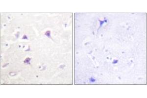 Immunohistochemistry analysis of paraffin-embedded human brain tissue, using HER4 (Ab-1284) Antibody. (ERBB4 Antikörper  (AA 1250-1299))