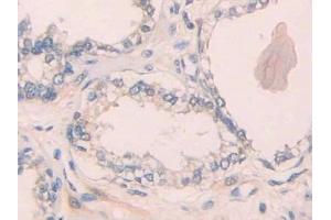 Immunohistochemistry (IHC) image for anti-Interleukin 1 Receptor, Type I (IL1R1) (AA 226-318) antibody (ABIN7437953)