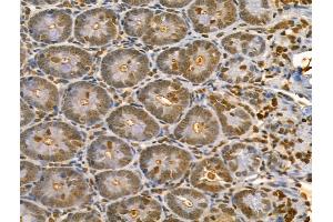 ABIN6262911 and ABIN6273052 at 1/100 staining Rat colon tissue by IHC-P.