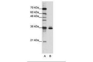 Image no. 3 for anti-Musashi Homolog 2 (MSI2) (AA 37-86) antibody (ABIN203056) (MSI2 Antikörper  (AA 37-86))