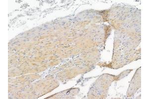 ABIN6259608 and ABIN6275729 at 1/100 staining human normal gastric tissue by IHC-P.