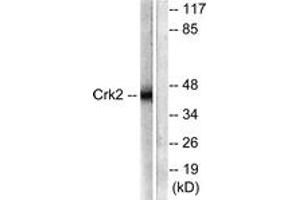 Western blot analysis of extracts from COS7 cells, using CrkII (Ab-221) Antibody. (Crk Antikörper  (AA 187-236))