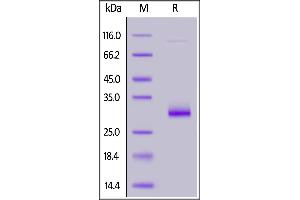 SDS-PAGE (SDS) image for V-Set and Immunoglobulin Domain Containing 8 (VSIG8) (AA 22-263) (Active) protein (His tag) (ABIN5526639)