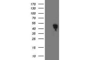 Western Blotting (WB) image for anti-Spermine Synthase, SMS (SMS) antibody (ABIN1501091) (SMS Antikörper)