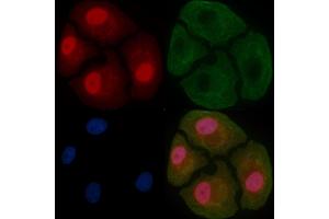 GATAD2A Mouse Monoclonal Antibody staining Hela cells by IF/ICC. (GATAD2A Antikörper)