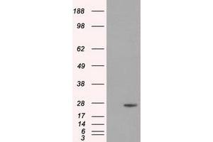 Image no. 4 for anti-Dicarbonyl/L-Xylulose Reductase (DCXR) antibody (ABIN1497785) (DCXR Antikörper)
